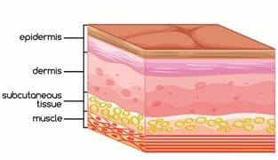 Skin concerns