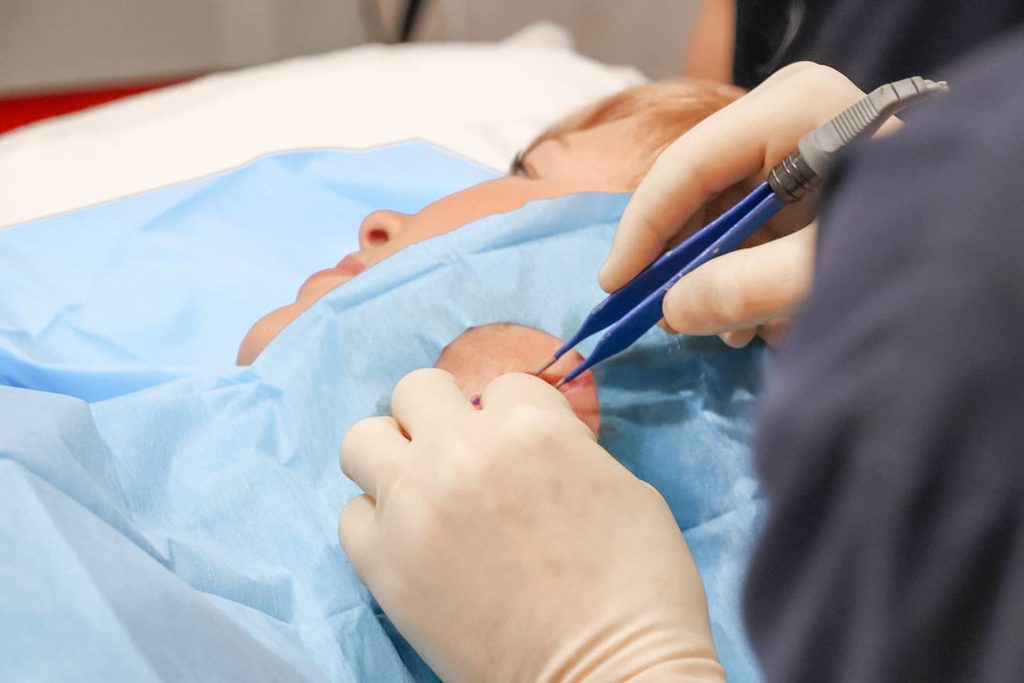 Skin Procedures Mole Removal Dr Mark Gittos - kybella nz