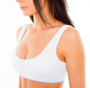Breast Implant Reduction - auckland-breast implant removal with breast lift breast-lift-surgery-dr-gittos