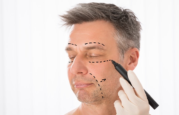 male facelift