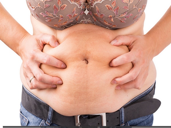 excess skin reduction surgery - tummy tuck or liposuction after weight loss, saggy skin, pregnancy