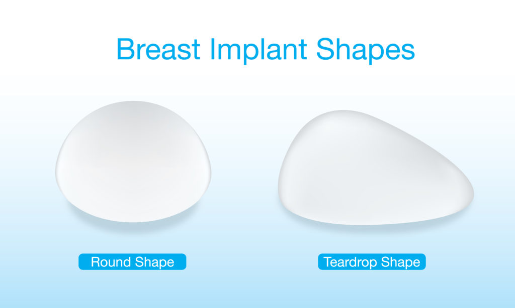 breast implants Auckland - breast implants melbourne shapes breast enhancement surgery options