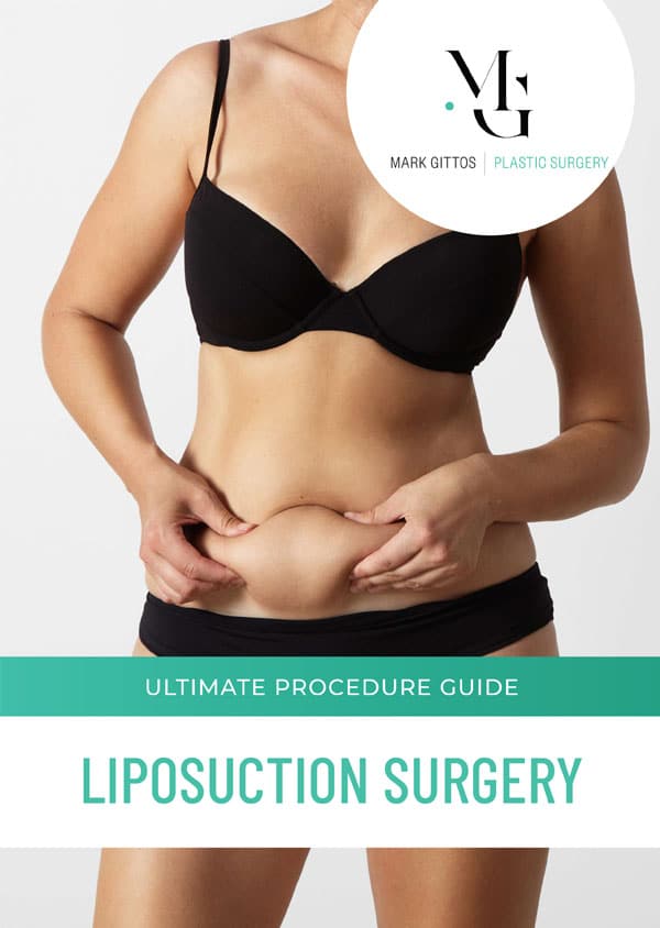 Guide Liposuction Surgery