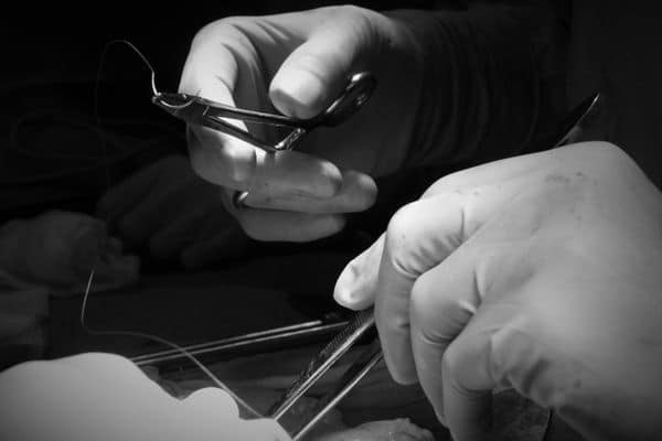 labiaplasty new zealand - Dr Mark Gittos Best Plastic Surgeon NZ