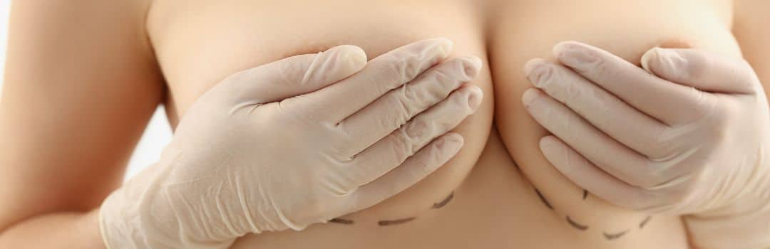 Which breast implant shape is best for you?